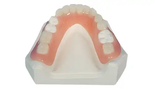 Acrylic Base Partial Denture Procurement for Removable Prosthetic Cases